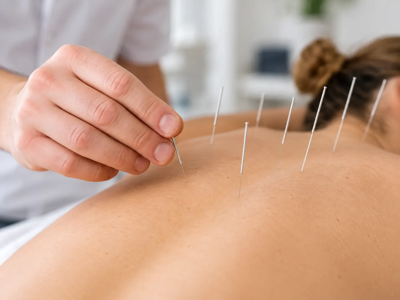 Dry needling bij Fysioleef
